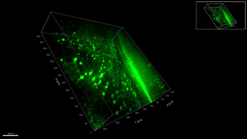 BPAE cells2-100X-SpinDisk-405&488&525